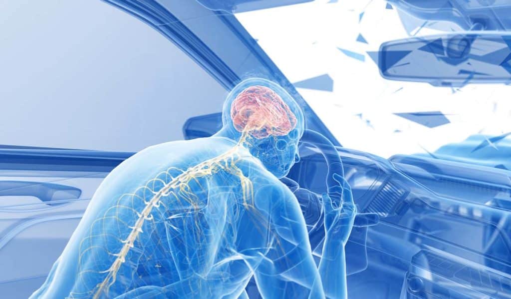 Understanding the Impact of Traumatic Brain Injuries in Car Accidents